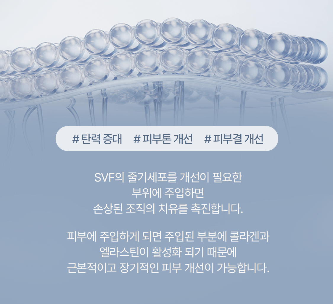 皮肤层上的细胞排列图形与SVF干细胞注射原理说明文字