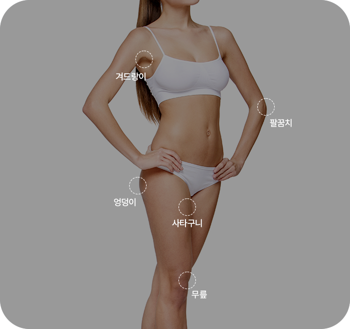 ボディ美白の施術部位の案内: 脇、ひじ、お尻、鼠径部、ひざ