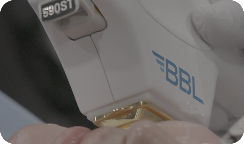 肌にBBL 590STフィルターのハンドピースを当てて施術する様子